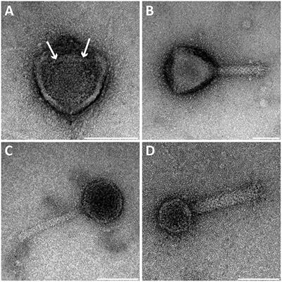 Ultrastructure and Viral Metagenome of Bacteriophages from an Anaerobic Methane Oxidizing Methylomirabilis Bioreactor Enrichment Culture